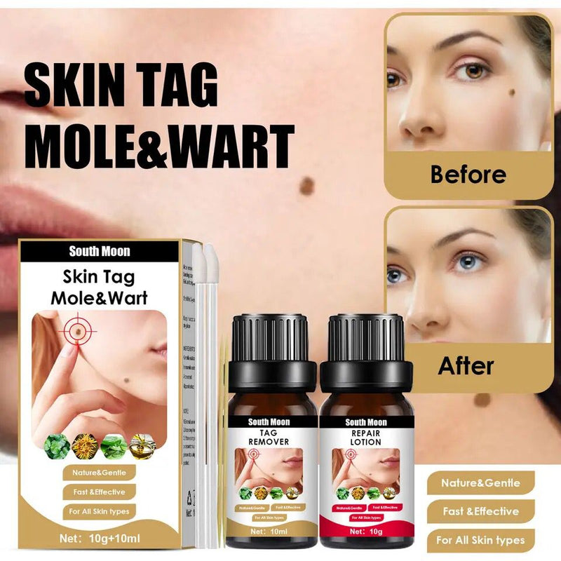 Warts Remover Against Moles Wart Liquid Treatment Cream Skin Tag Remover Herbal Extract Anti Verruca Remedy Wart Repair Ointment - Tuzzut.com Qatar Online Shopping