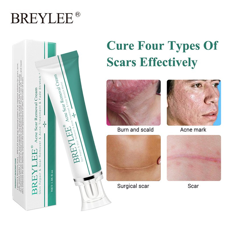 BREYLEE Acne Scar Removal Cream Skin Repair Skin Care Scar Acne