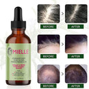 Mielle Rosemary Mint Scalp & Hair Strengthening Oil For Healthy Hair Growth, 2 oz (59ml) - TUZZUT Qatar Online Shopping
