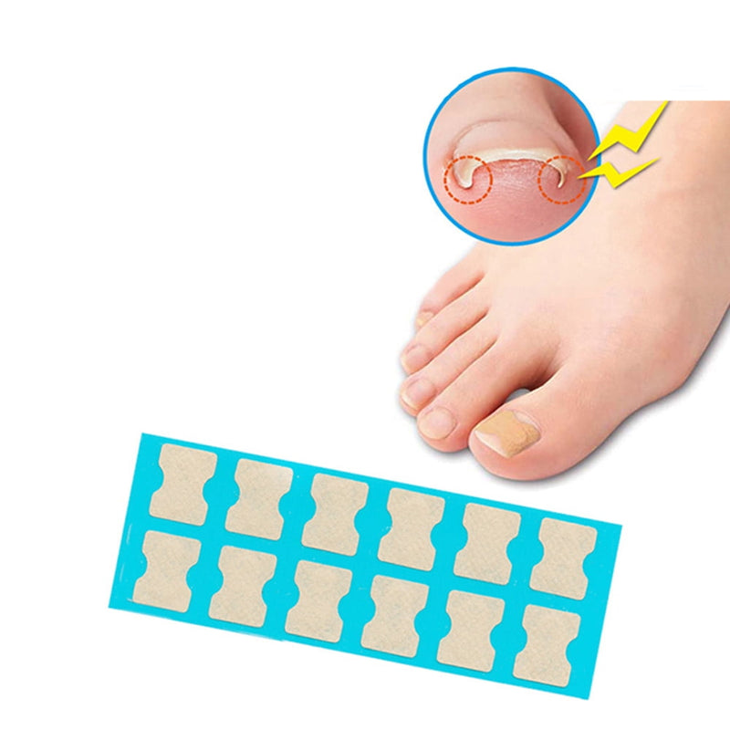 Andoer Ingrown Nail Correction Kit Ingrown Toenail Stickers Toe Nail Clamp & Lifter Straightening Recover Corrector Toe Nail Fingernail Care Tool - Tuzzut.com Qatar Online Shopping