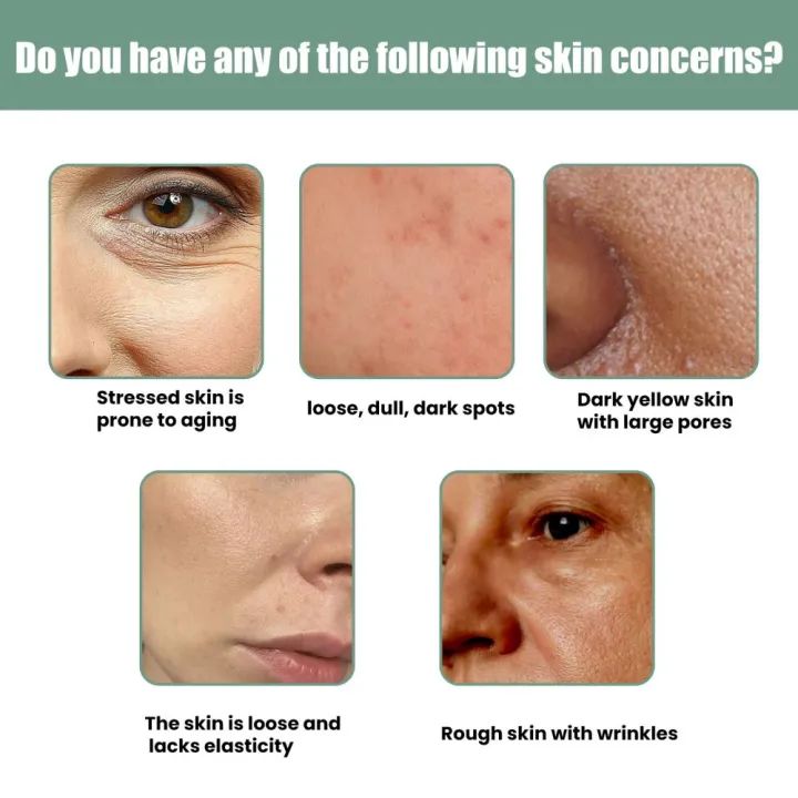 Eelhoe Advanced Collagen Boost Face Serum Lifting Firming Fade Fine Lines Wrinkle Anti-aging Facial Essence Brightening Skin Tone Whitening Moisturizing Face Nourishing Skin Care Booster Serum(30ml Eelhoe Advanced Collagen Boost Face Serum Lifting Firming Fade Fine Lines Wrinkle Anti-aging Facial Essence Brightening Skin Tone Whitening Moisturizing Face Nourishing Skin Care Booster Serum(30ml