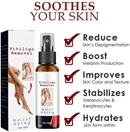 Vitiligo Relief Spray,eelhoe Vitiligo Relief Spray,Whitening spot 30ml Vitiligo Relief Spray,eelhoe Vitiligo Relief Spray,Whitening spot 30ml