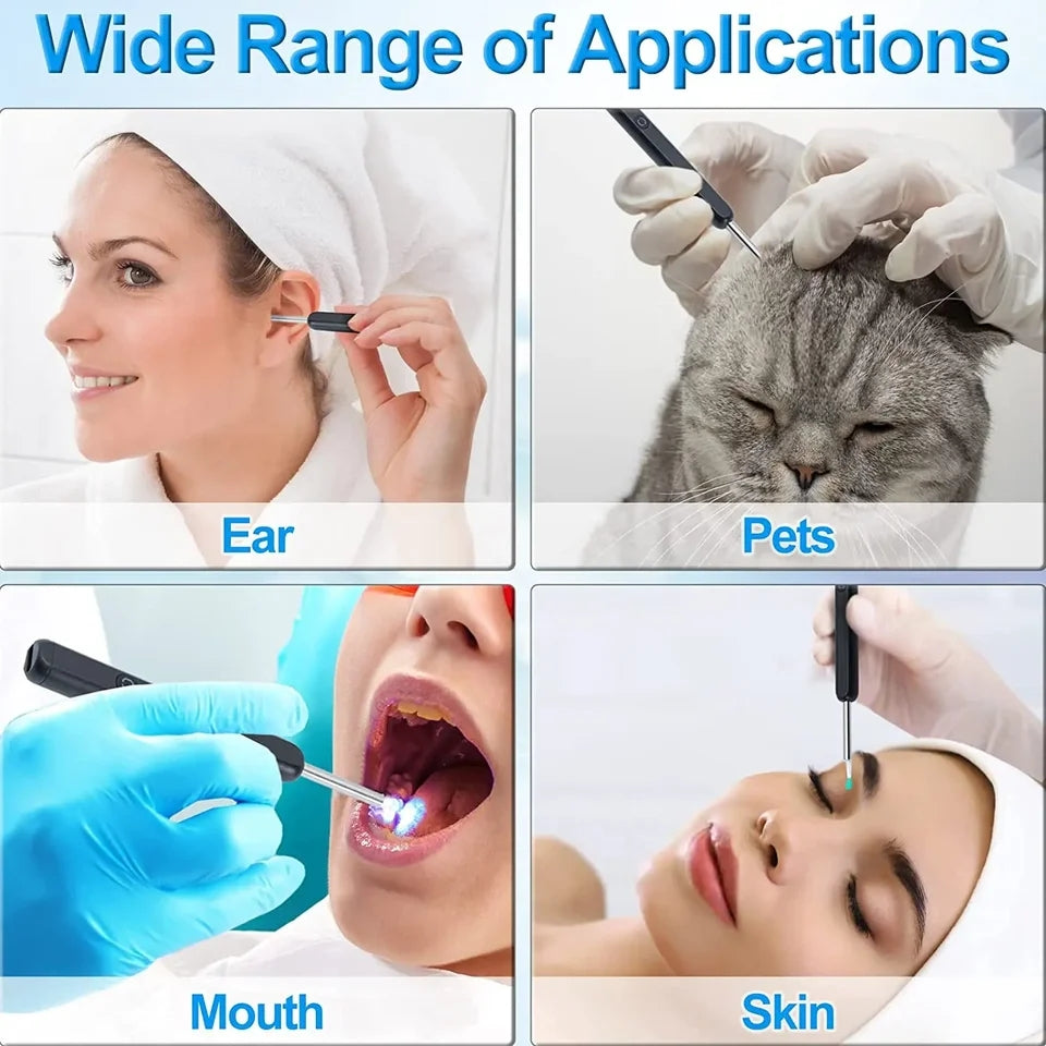 NE3 Wireless Smart Visual Ear Cleaner with Camera & LED light NE3 Wireless Smart Visual Ear Cleaner with Camera & LED light