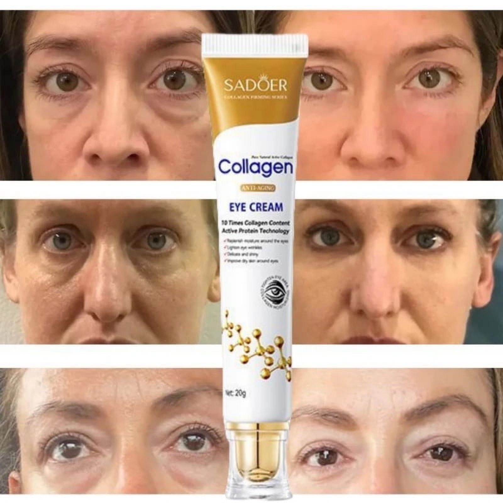 SADOER Collagen Instant Eye Bag Removal Cream 20g SADOER Collagen Instant Eye Bag Removal Cream 20g