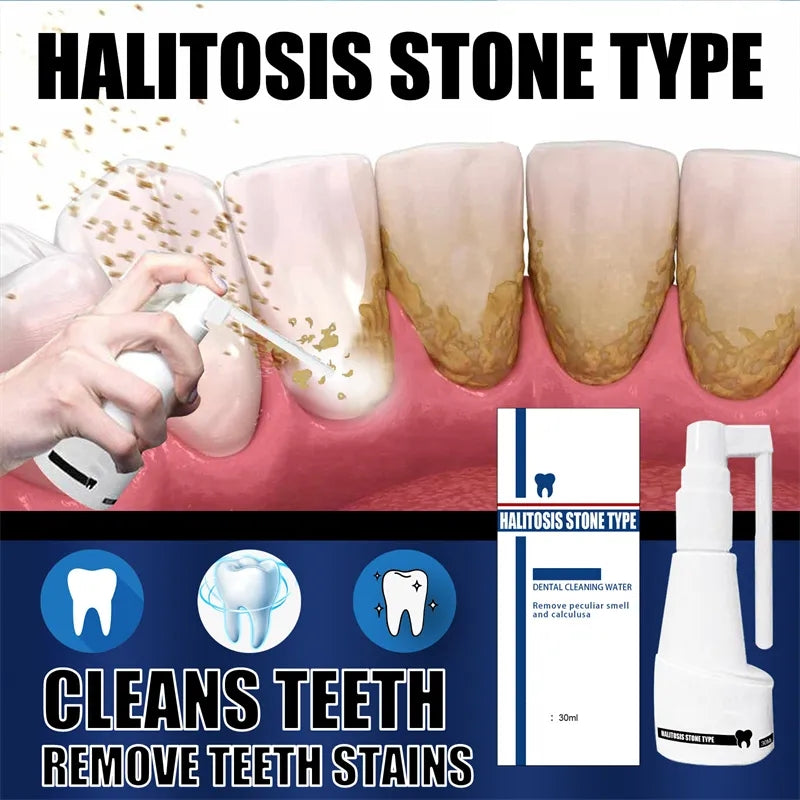 30ml Dental Calculus Cleaning Halitosis Stone Remove Teeth Whitening Spray
