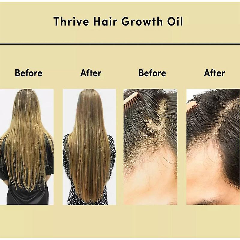 60ml Carvenchy Oil, Veganic Oil Anti Treatments Nourishing Scalp 60ml Carvenchy Oil, Veganic Oil Anti Treatments Nourishing Scalp