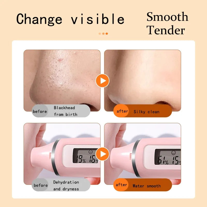 Carrot Foam Mask with Acid Complex Deep Bubble Cleaning Pore Cleansing , Blackhead removal, Exfoliation, Moisturizing (4gm x 12pcs Pack) Carrot Foam Mask with Acid Complex Deep Bubble Cleaning Pore Cleansing , Blackhead removal, Exfoliation, Moisturizing (4gm x 12pcs Pack)