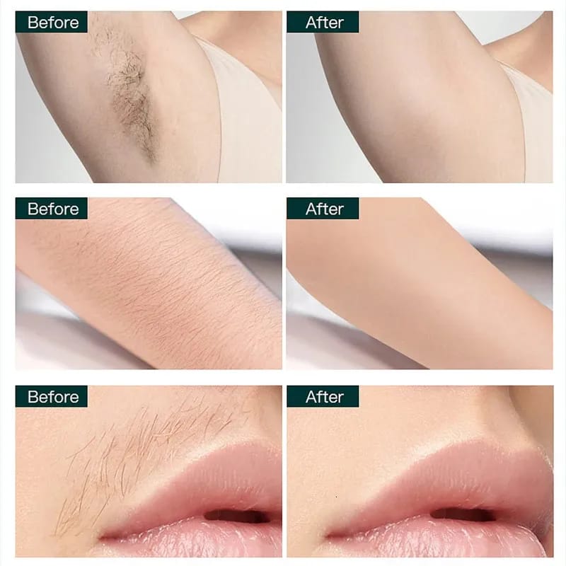 Rechargeable Hair Remover  SG-665 - TUZZUT Qatar Online Shopping