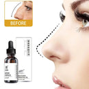 Nose Essential Oil Lift Up Heighten Rhinoplasty Collagen Firming - TUZZUT Qatar Online Shopping