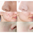 Carrot Foam Mask with Acid Complex Deep Bubble Cleaning Pore Cleansing , Blackhead removal, Exfoliation, Moisturizing (4gm x 12pcs Pack) - Tuzzut.com Qatar Online Shopping