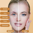 Kojic Acid Soap, Skin Lightening Soap - TUZZUT Qatar Online Shopping