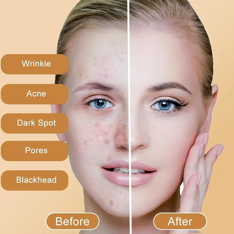 Kojic Acid Soap, Skin Lightening Soap - TUZZUT Qatar Online Shopping