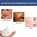 50ml Whitening Facial Cleanser Amino Acid Foam Scrub Cleansing Anti-Acne Oil - Tuzzut.com Qatar Online Shopping