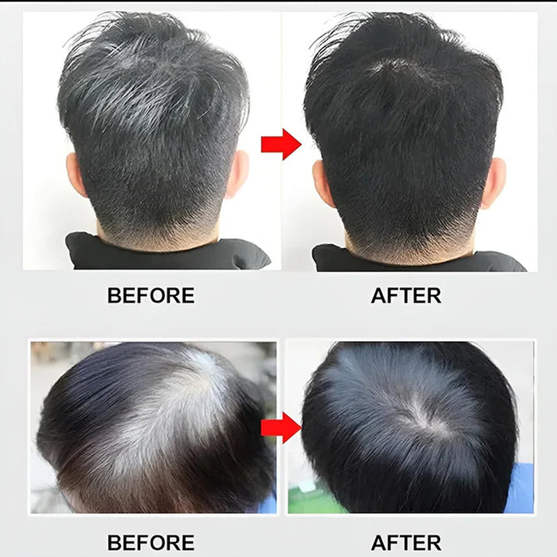 Apple 96 Natural Black Hair Dye Ammonnia Free Hair Colour Cream (500ml* 2) Pack - TUZZUT Qatar Online Shopping