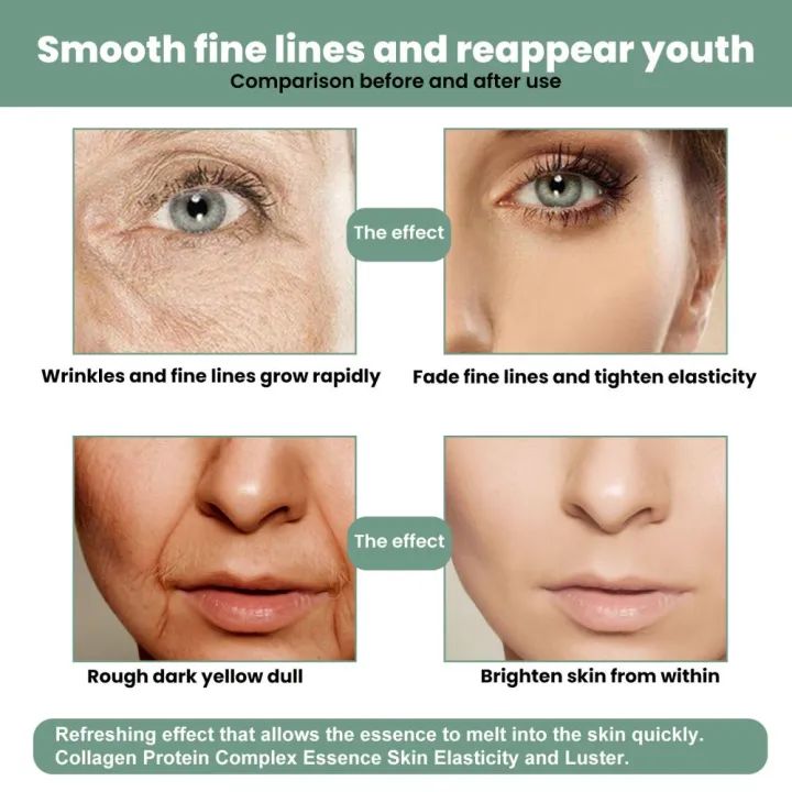 Eelhoe Advanced Collagen Boost Face Serum Lifting Firming Fade Fine Lines Wrinkle Anti-aging Facial Essence Brightening Skin Tone Whitening Moisturizing Face Nourishing Skin Care Booster Serum(30ml Eelhoe Advanced Collagen Boost Face Serum Lifting Firming Fade Fine Lines Wrinkle Anti-aging Facial Essence Brightening Skin Tone Whitening Moisturizing Face Nourishing Skin Care Booster Serum(30ml