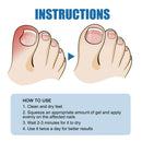 Toe Fungus Hand Foot Removal Gel Nail
