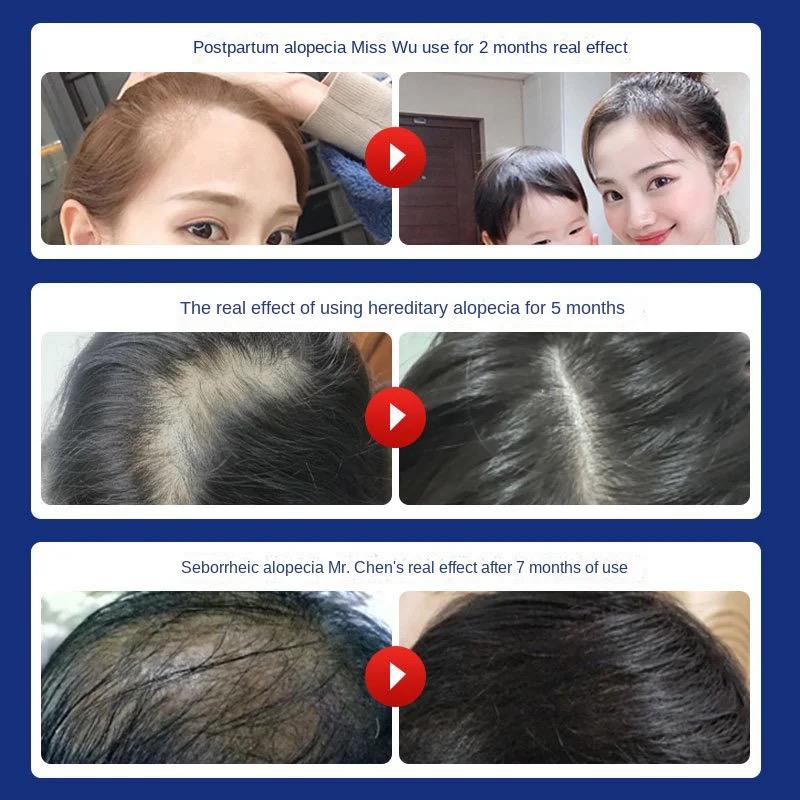 Dr Shampoo for Hair Loss Prevention with Traditional Chinese Medicine