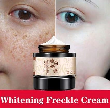 Powerful whitening freckle cream