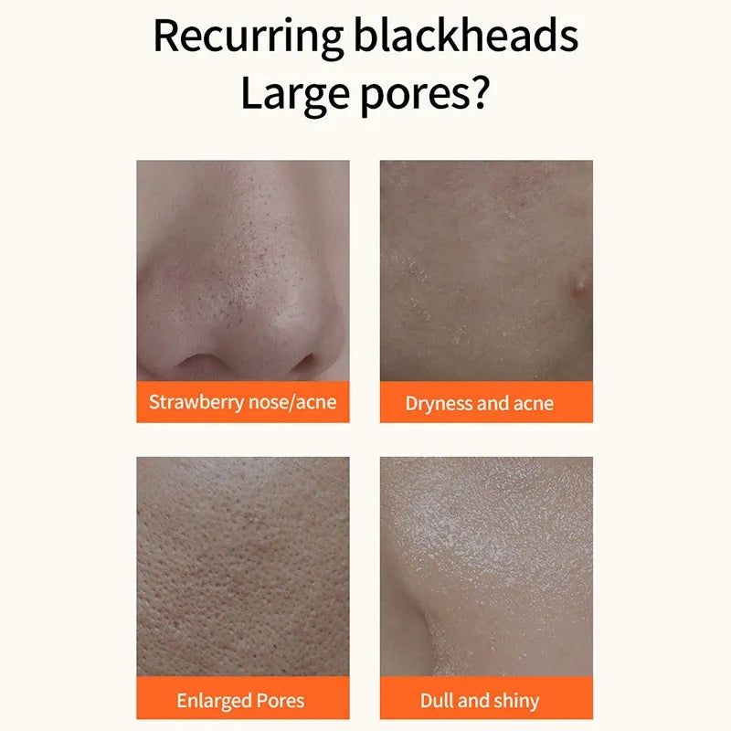 Carrot Foam Mask with Acid Complex Deep Bubble Cleaning Pore Cleansing , Blackhead removal, Exfoliation, Moisturizing (4gm x 12pcs Pack) Carrot Foam Mask with Acid Complex Deep Bubble Cleaning Pore Cleansing , Blackhead removal, Exfoliation, Moisturizing (4gm x 12pcs Pack)
