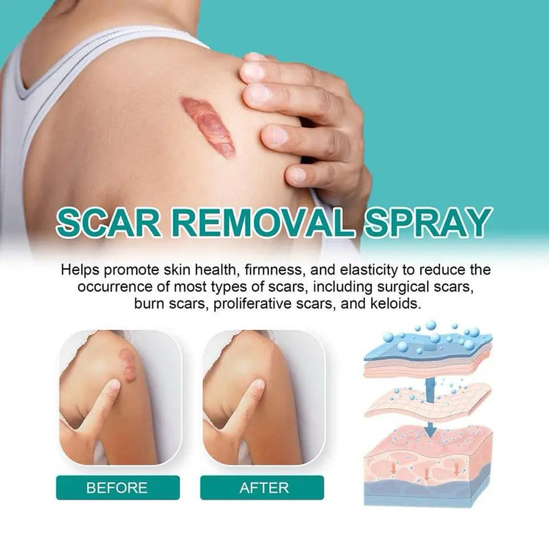 Scar Removal Spray Fade Scar -20g - Tuzzut.com Qatar Online Shopping