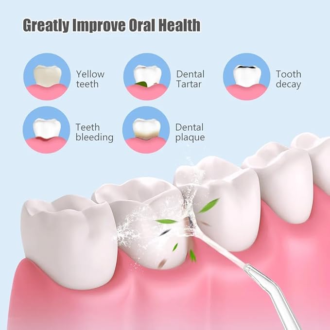 ORAL IRRIGATOR Convenient Electric Tooth Flushing ORAL IRRIGATOR Convenient Electric Tooth Flushing