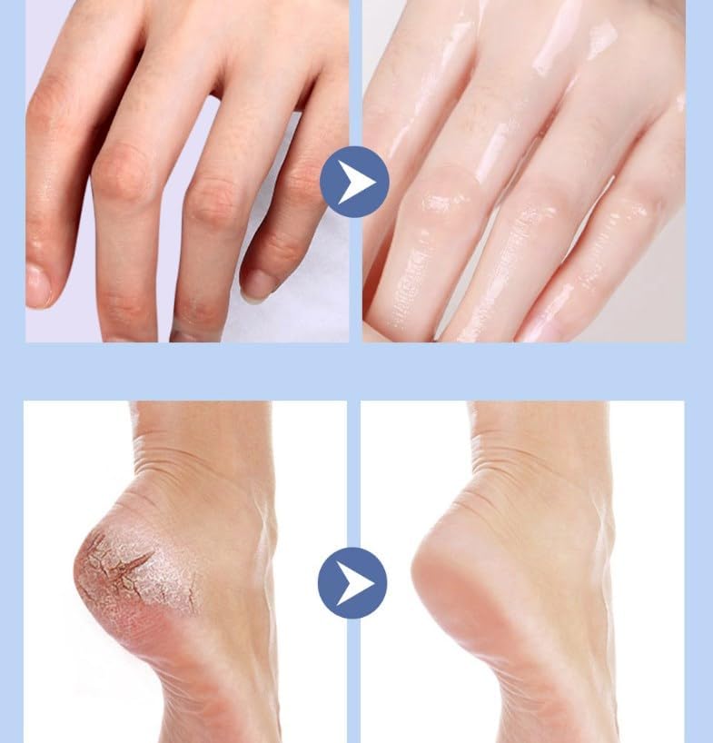 Foot Care Cream Cracked Feet, Crack Feet Prevention Stick, FootBalm, Foot Balm Stick for Dry Cracked Feets, Anti Cracking Foot Cream Roll On, Hydrating FT22 - TUZZUT Qatar Online Shopping