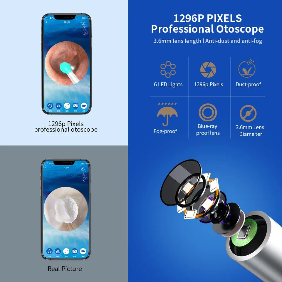NE3 Wireless Smart Visual Ear Cleaner with Camera & LED light NE3 Wireless Smart Visual Ear Cleaner with Camera & LED light