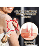 Vitiligo Removal Cream, Skin Vitiligo Treatment, Vitiligo Care Cream Reduces White Spots and Improves Skin Pigmentation (20g) B-389470 - TUZZUT Qatar Online Shopping