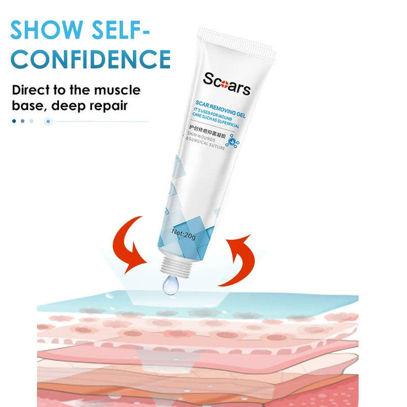 Skin Repair Scar Removal Gel Cream - 20gm - Tuzzut.com Qatar Online Shopping