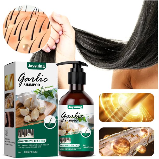 Garlic Shampoo Deep Cleansing Effective Hair Loss Treatment Garlic Shampoo Deep Cleansing Effective Hair Loss Treatment