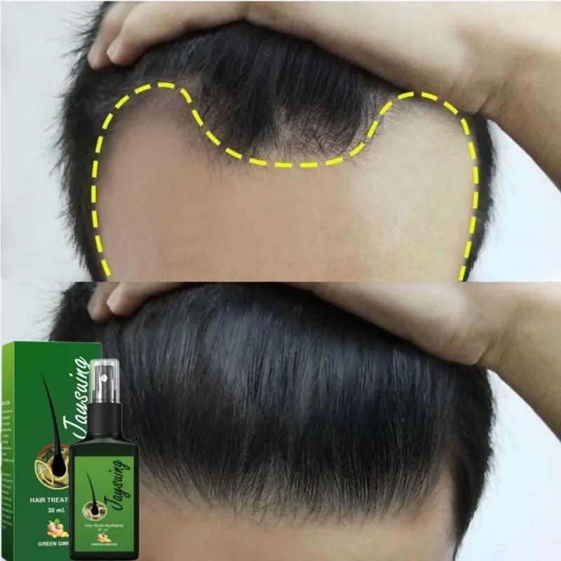 Natural Ginger Hair Growth Spray Jaysuing 120ml Natural Ginger Hair Growth Spray Jaysuing 120ml