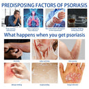 SOUTH MOON Psoriasis Removal Ointment Eczema Best Anti Dermatitis - Tuzzut.com Qatar Online Shopping