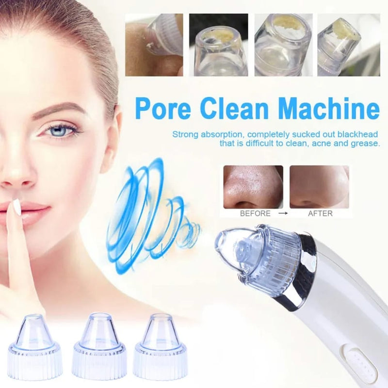 Electric Blackhead Remover Acne Pro Vacuum Pore Cleaner Exfoliating Cleansing Comedo Suction Facial Beauty Machine X2674310 - Tuzzut.com Qatar Online Shopping