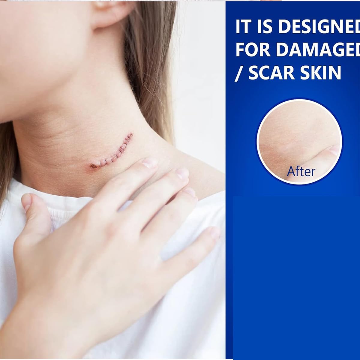 Jellico Scar Removing Gel 20g Jellico Scar Removing Gel 20g