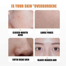 Carrot Foam Mask with Acid Complex Deep Bubble Cleaning Pore Cleansing , Blackhead removal, Exfoliation, Moisturizing (4gm x 12pcs Pack) - Tuzzut.com Qatar Online Shopping