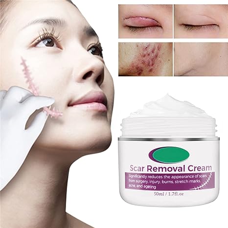 Scar Remove Cream Desalination Acne Mark Repair Scars Scarless Scald Scars Scar Remove Cream Desalination Acne Mark Repair Scars Scarless Scald Scars