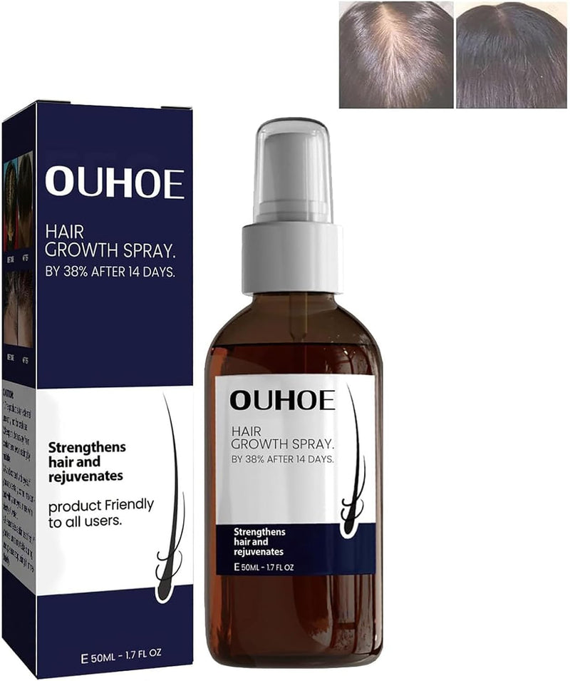 OUHOE Hair Growth Spray 50ml - TUZZUT Qatar Online Shopping