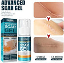 50ML Advanced Scar Gel - Tuzzut.com Qatar Online Shopping