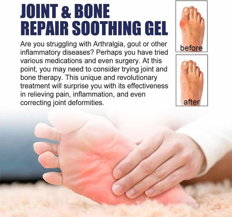 Eelhoe Advanced Joint & Bone Therapy Bee Venom Gel 30ml - TUZZUT Qatar Online Shopping