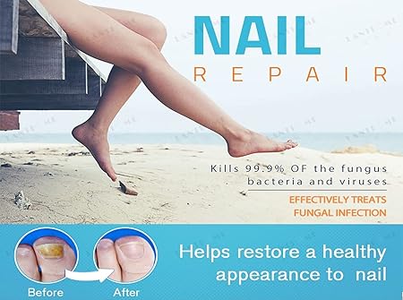 Lanthome Nail Repair Toenail and Nail - Tuzzut.com Qatar Online Shopping