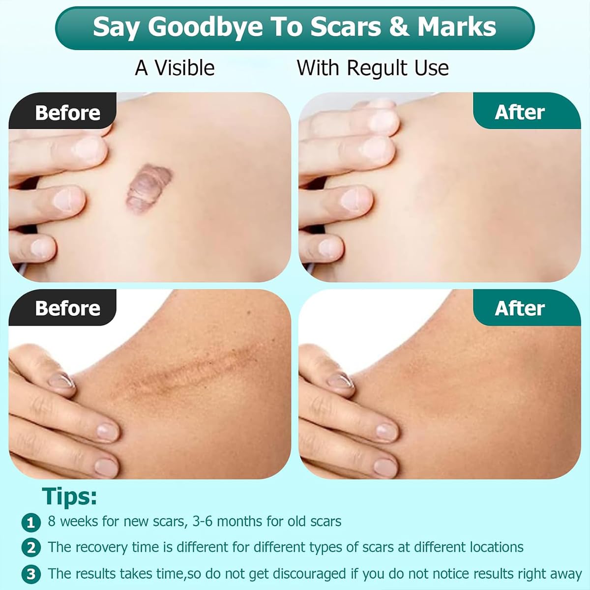Jellico Scar Removing Gel 20g Jellico Scar Removing Gel 20g