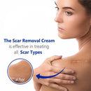 Jellico Scar Removing Gel 20g - TUZZUT Qatar Online Shopping