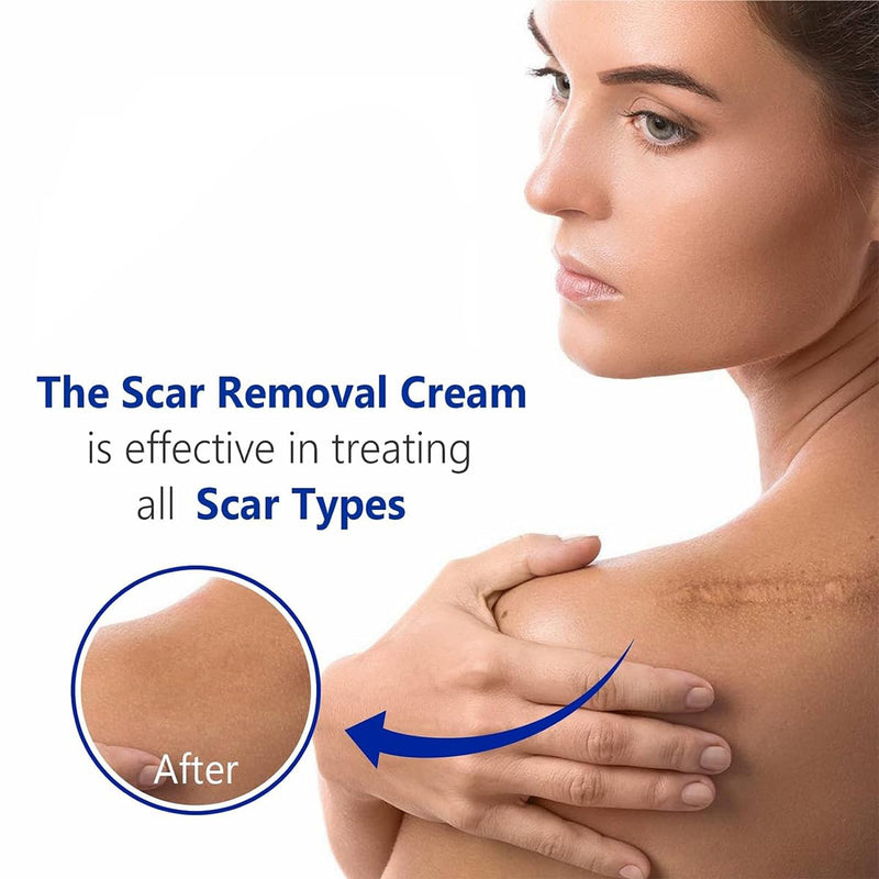 Jellico Scar Removing Gel 20g - TUZZUT Qatar Online Shopping