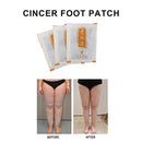 10 Pcs Ginger Foot Patch Detox Loss Weight Foot Patches Improve Sleep Feet Patch Anti- Swelling Revitalizing - Tuzzut.com Qatar Online Shopping