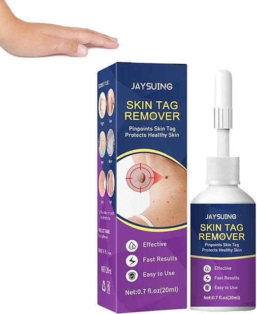 Wart Removal Cream | 20ml Wart Remover Corn Removers for Feet and Hands