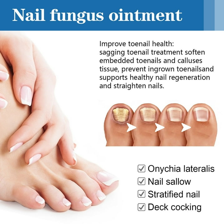 Toe Fungus Hand Foot Removal Gel Nail