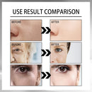 Ouhoe Advanced Snail 92 All-in-One Cream - 100g - TUZZUT Qatar Online Shopping