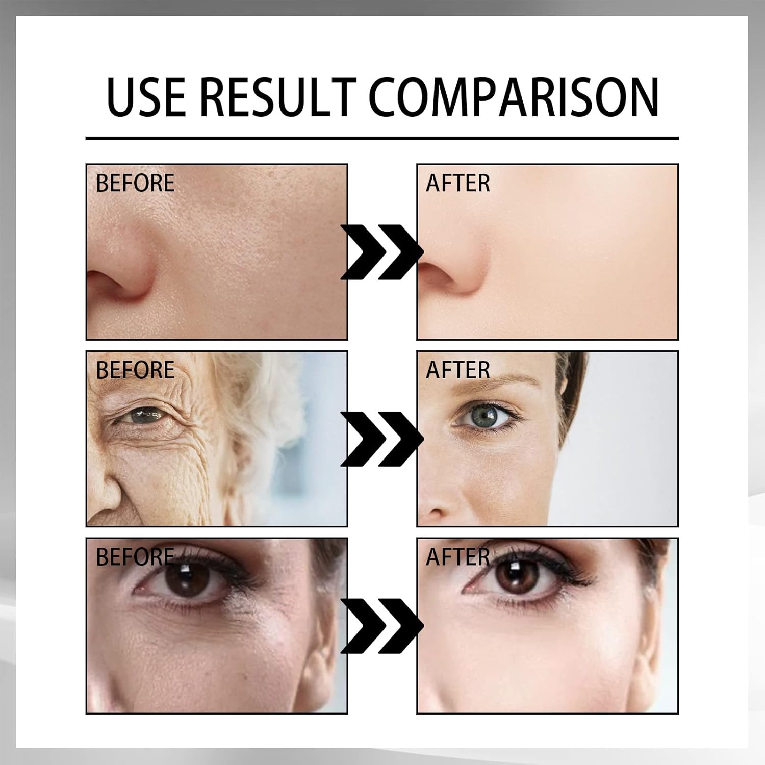 Ouhoe Advanced Snail 92 All-in-One Cream - 100g Ouhoe Advanced Snail 92 All-in-One Cream - 100g