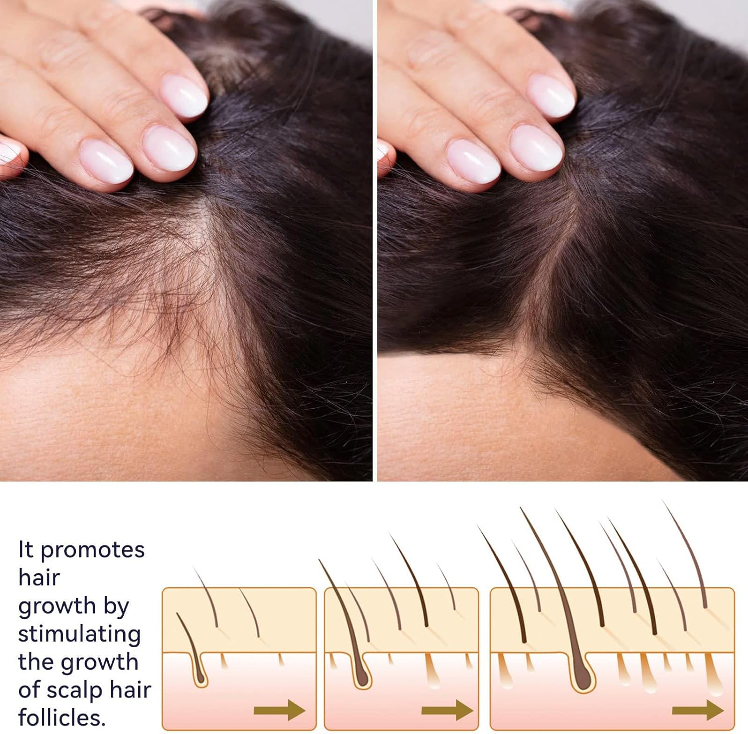 OUHOE Hair Growth Spray 50ml OUHOE Hair Growth Spray 50ml