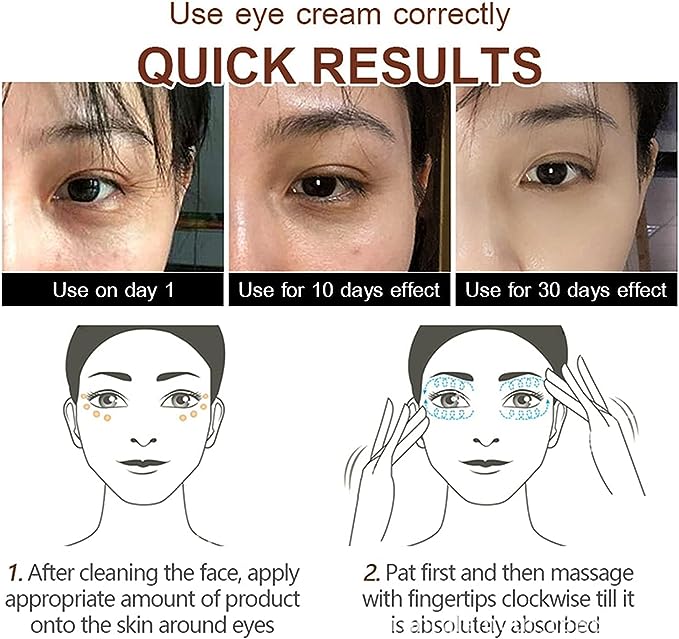 Magic Eye Cream, 28 Seconds to Remove Eye Bags, Wrinkles, Fine Lines, Dark Circles S4720855
